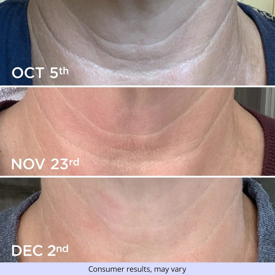 GOPURE Tighten & Lift Neck Cream