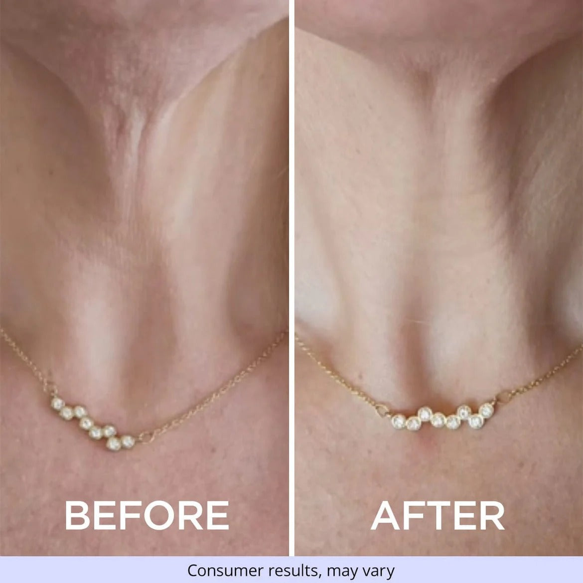 GOPURE Tighten & Lift Neck Cream