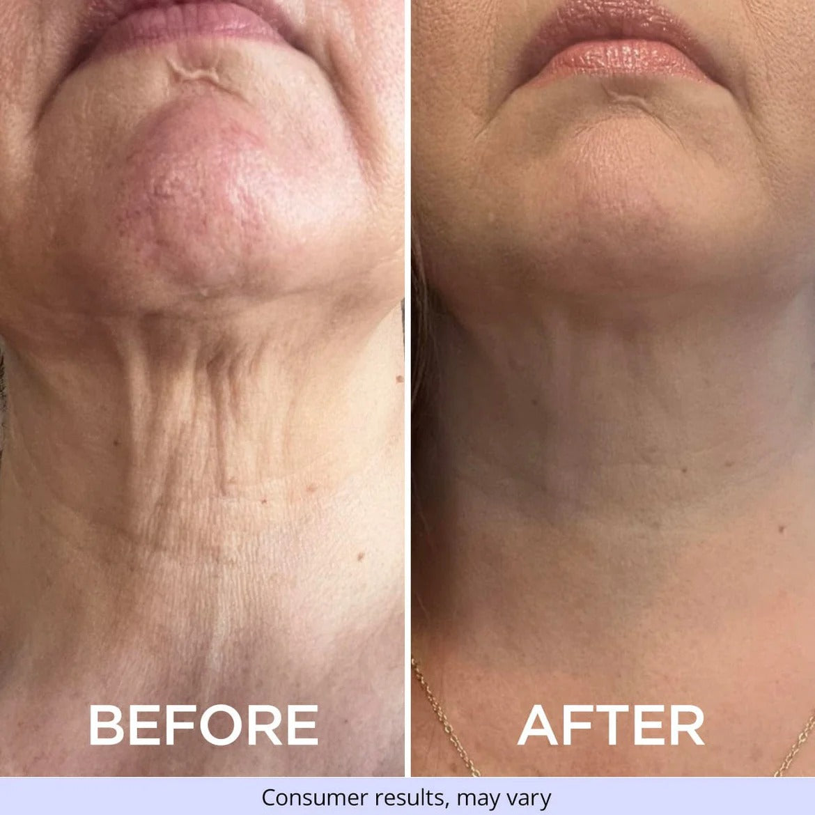 GOPURE Tighten & Lift Neck Cream