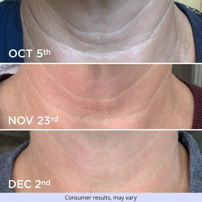 GOPURE Tighten & Lift Neck Cream